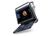 Portable Digital Color Doppler Ultrasound System EBit 60