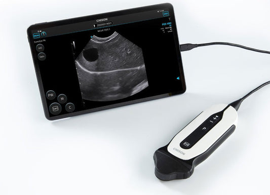 Revolutionizing Point-of-Care Diagnostics: The Handheld Digital Color Doppler Ultrasound System SonoEye P6