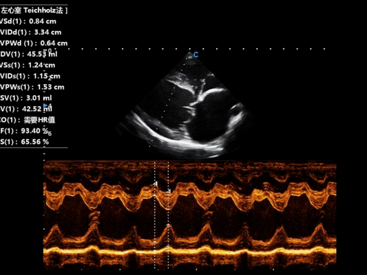 Myxomatous Mitral Valve Disease in Canine